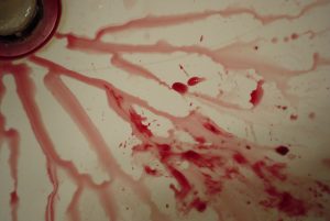 Read more about the article UTI Bleeding When I Wipe Story