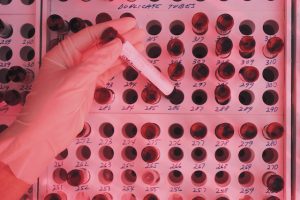 Read more about the article Blood Culture Safety For Tropical Travel