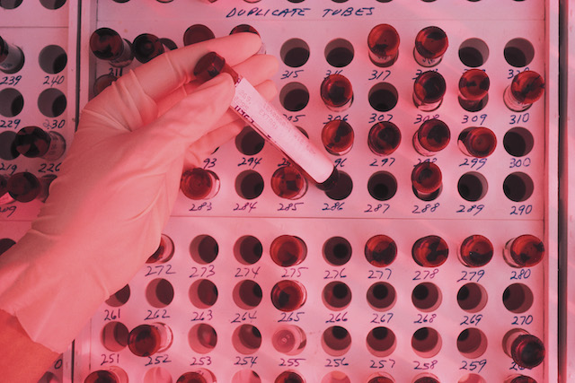 Blood culture