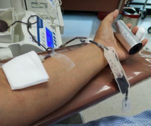 Read more about the article Bone Marrow Donation And Air Travel