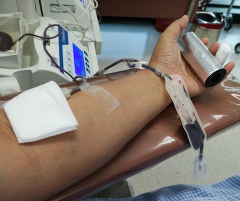 Bone marrow donation