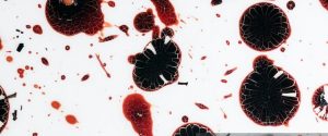 Read more about the article Whole Blood Testing For Airline Pilots