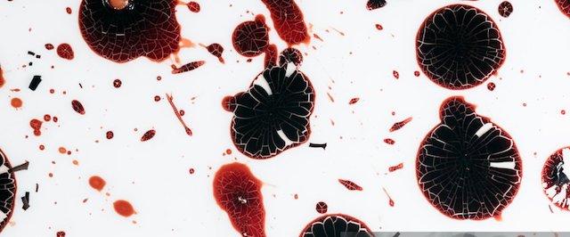 Whole blood