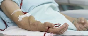 Read more about the article Leukapheresis in Space Explorers And Pilots