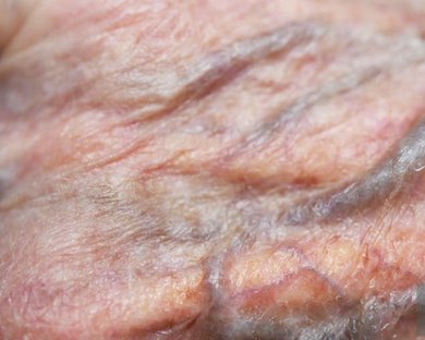 Read more about the article Blood flow Patterns In Space Explorers