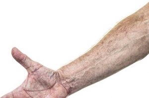 Read more about the article Arm Veins Of Astronauts In Spaceflight Missions